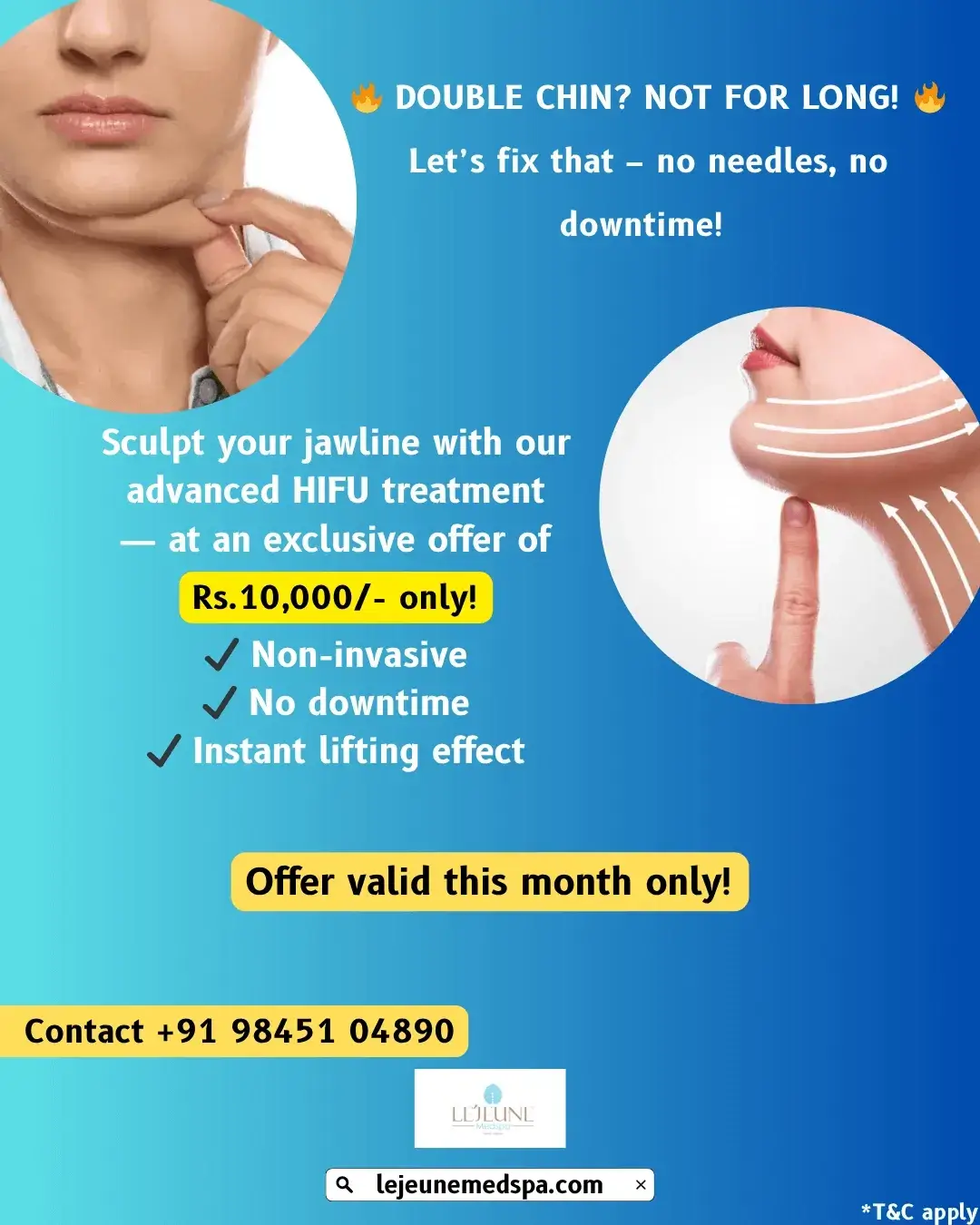 Double Chin? Not For Long!